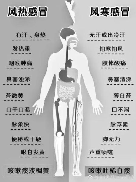 风寒和风热感冒的区别和症状 风热感冒的治疗方法